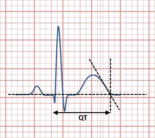 File:QT interval.jpg