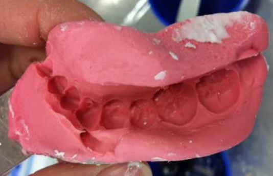 File:Alginate impression body.jpg