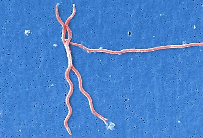File:Lyme disease parasite Borrelia burgdorferi.jpg