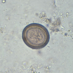 File:Taenia egg.jpg