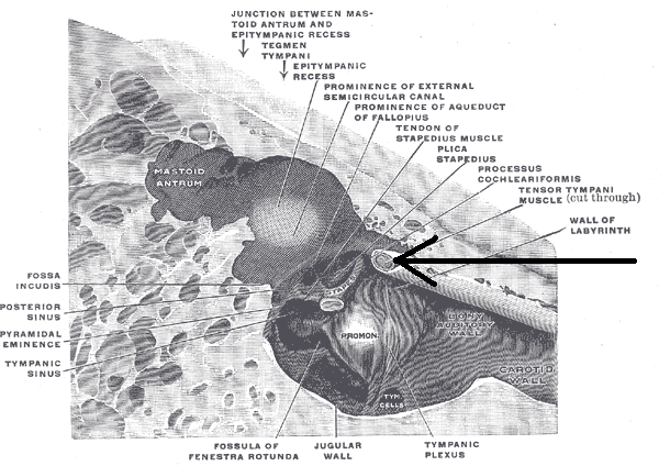 File:Musculustensortympani.png