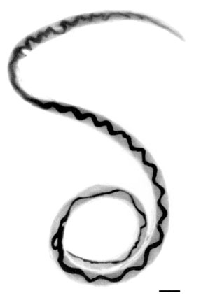 File:Angiostrongylus cantonensis.png
