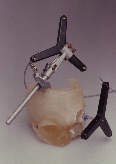 File:StereolithographiemodellSchaedel.jpg