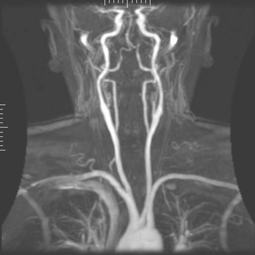 File:Mra1.jpg