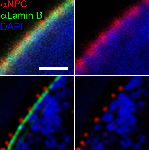 File:3D-SIM-1 NPC Confocal vs 3D-SIM detail.jpg