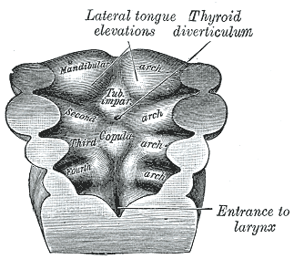 File:Gray42.png