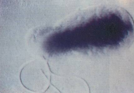 File:Bartonella.jpg
