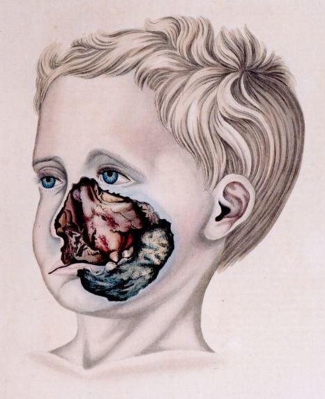 File:Noma (cropped).jpg