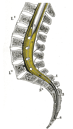 File:Gray661.png