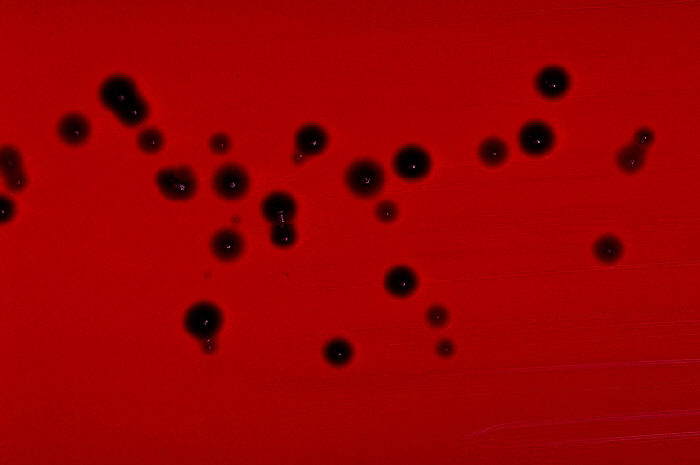 File:Chromobacterium violaceum blood agar.jpg
