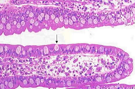 File:Gobletcell.jpg