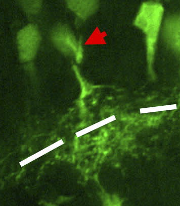 File:Amacrine.png