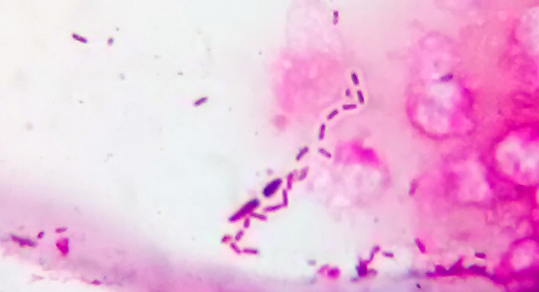 File:Bacteria with capsule.jpg