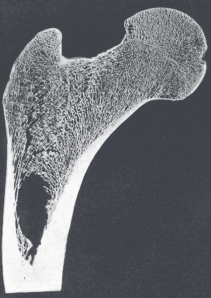 File:Gray247.png