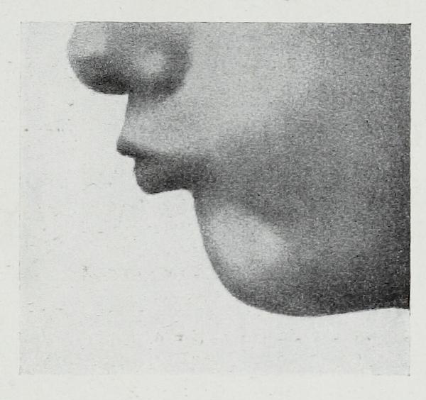 File:Braus 1921 376.png