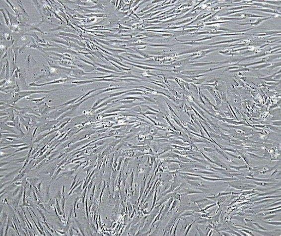File:Human Aortic SMC.jpg