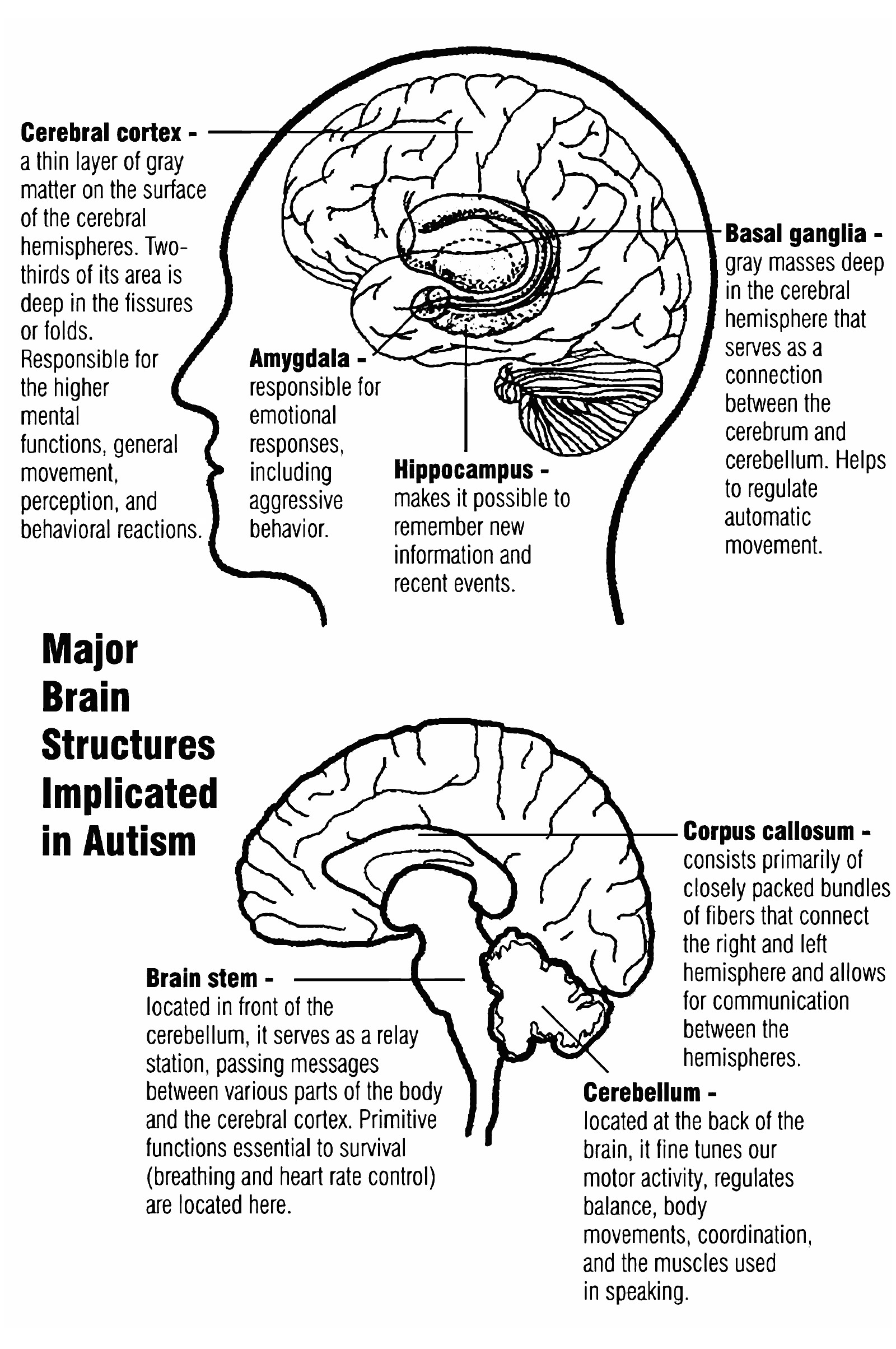 Brain scan of autism