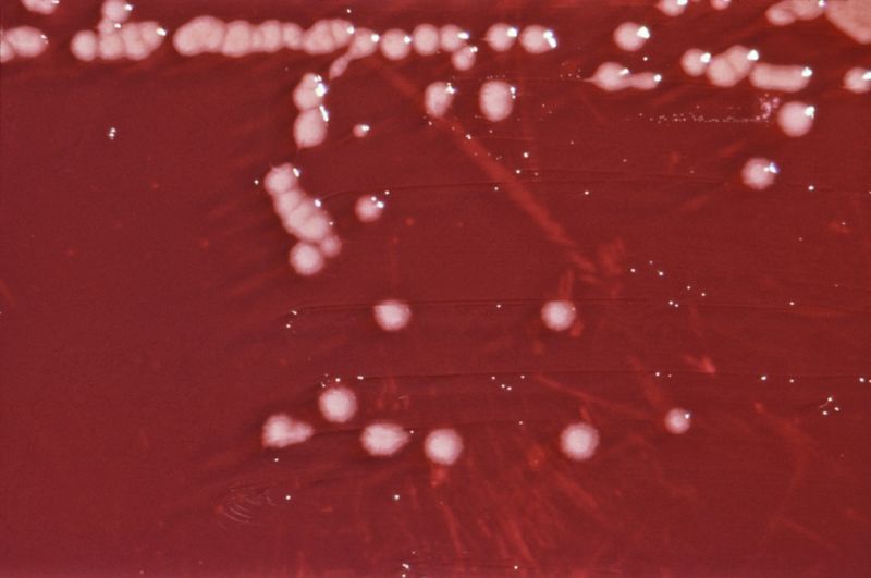 File:Pseudomonas aeruginosa 01.jpg