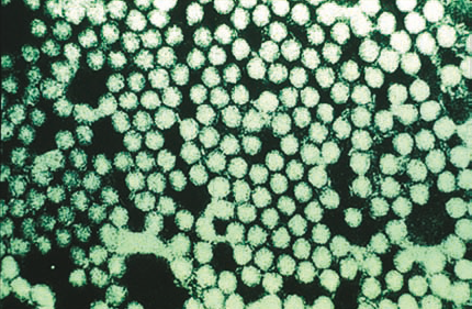 File:Electronmicrograph of the foot-and-mouth disease virus.png