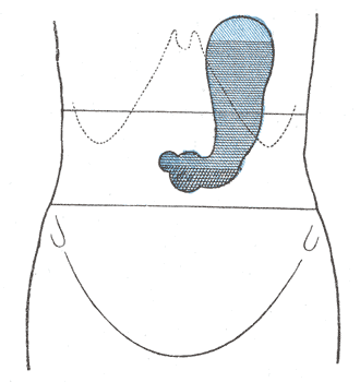 File:Gray1221.png