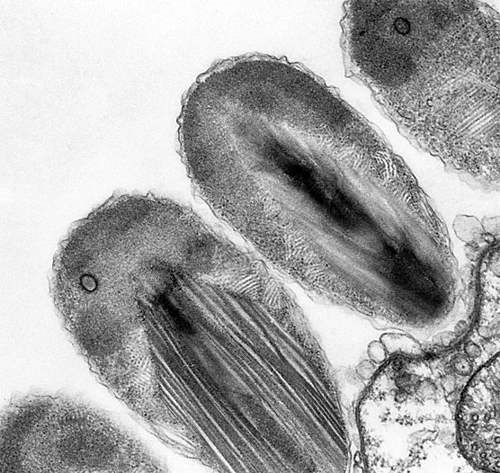 File:TEM - Epixenosomes.jpg