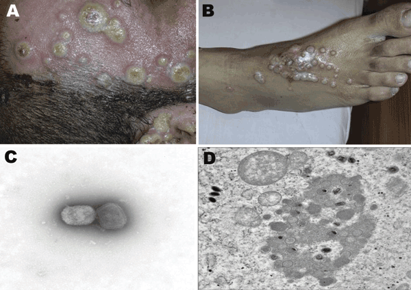 File:Buffalopox infection.png