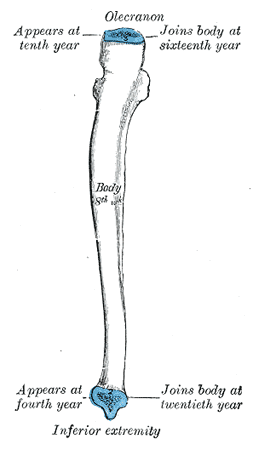 File:Gray215.png