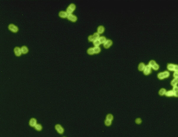 File:Pneumococcus CDC PHIL ID1003.jpg