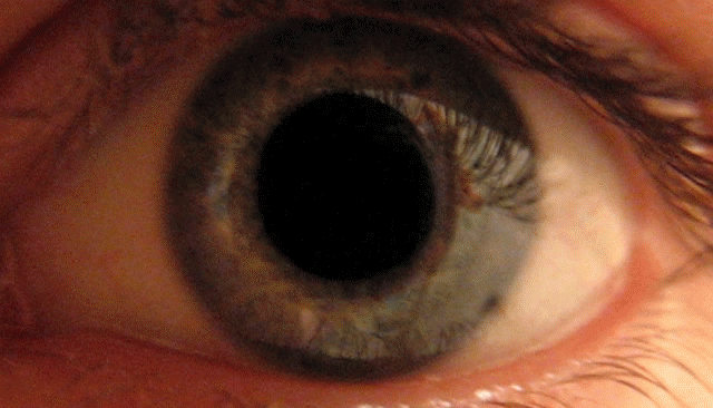 File:Eye dilate.gif
