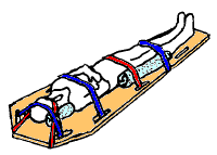 File:Immobilisation plan dur.png