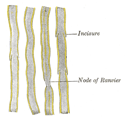 File:Gray630.png