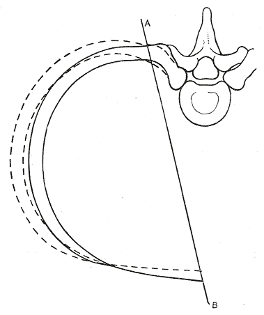 File:Gray318.png
