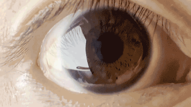 File:Voluntary pupil dilation.gif