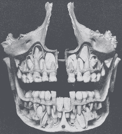 File:Gray1001.png