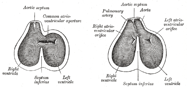 File:Gray470.png