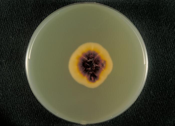 File:Trichophyton rubrum var. rodhaini PHIL 4248 lores.jpg