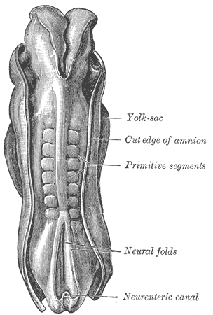 File:Gray20.png