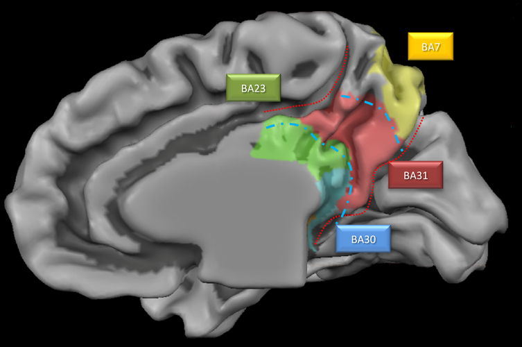 File:Medial parietal lobe close up.png