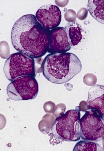 File:AML-M2.jpg