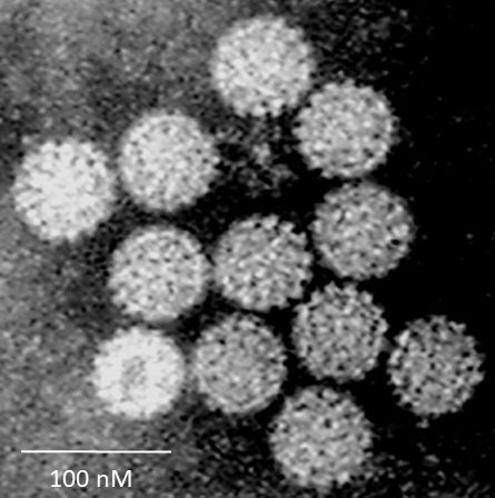 File:Papilloma Virus (HPV) EM (new version).jpg