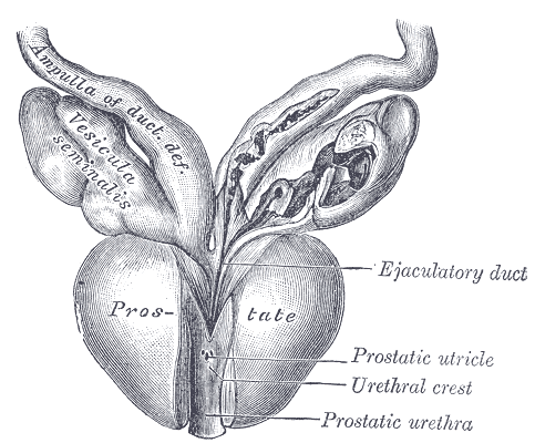 File:Gray1153.png