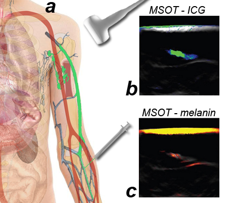 File:14m msot.jpg