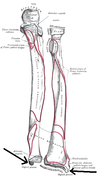 File:Processusstyloideusradii.png