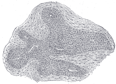 File:Gray1187.png