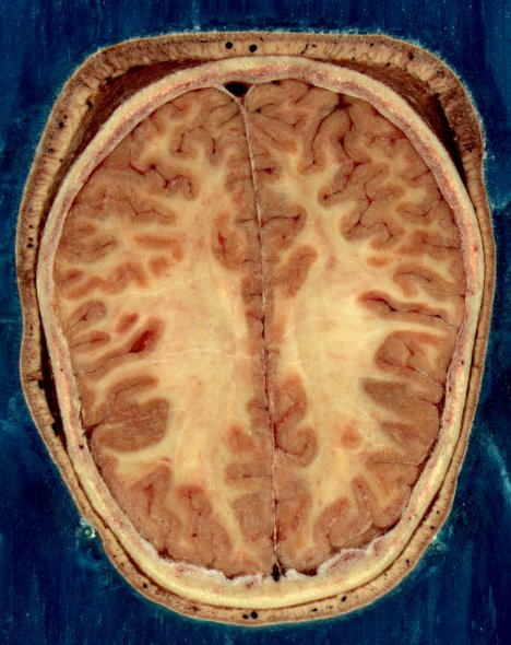 File:Visible Human head slice.jpg