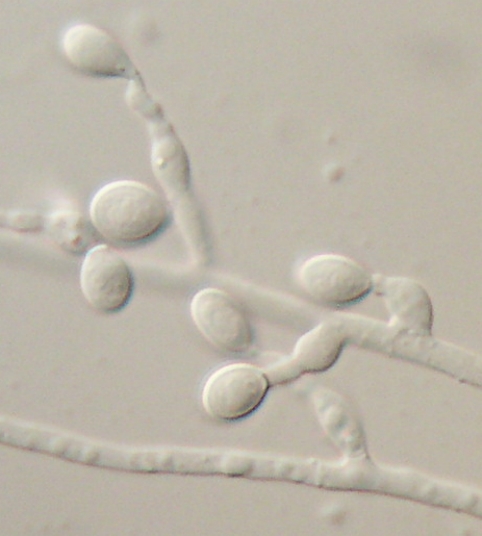 File:Scedosporium prolificans.jpg
