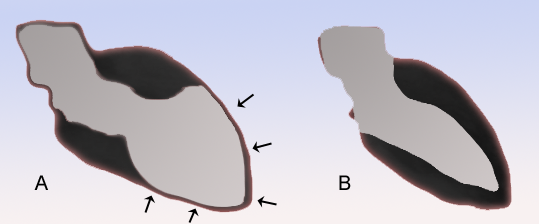 File:TakoTsubo scheme.png