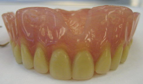 File:Mr M's Complete Denture2.jpg