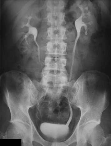 File:Ivu 1.jpg