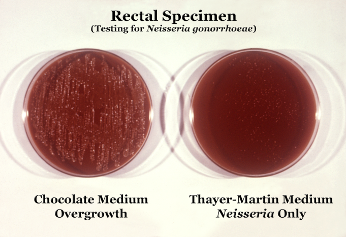 File:Neisseria gonorrhoeae 01.png